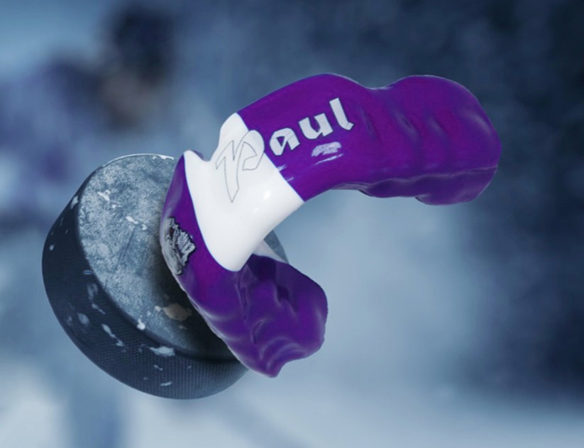 Image montrant un protège-dents personnalisé fabriqué au laboratoire JC Anjou Dental